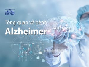 bệnh Alzheimer