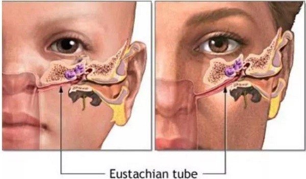Rối loạn chức năng ống Eustachian