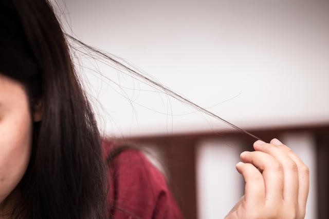 Căng thẳng làm tăng nguy cơ gây ra chứng nghiện nhổ tóc